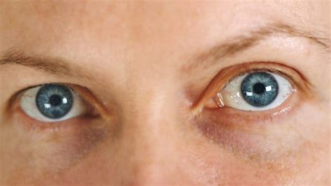 What Are The Most Common Eye Problems Among People?