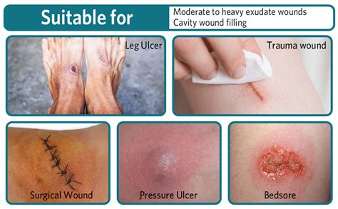 amazoncom bestek silicone foam dressing  border adhesive