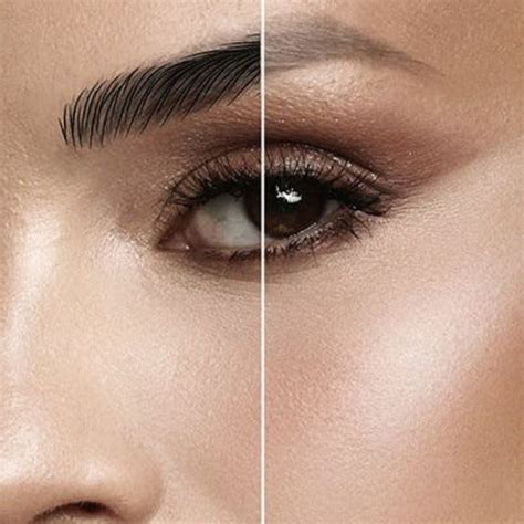 rimozione tatuaggi mimicao torino