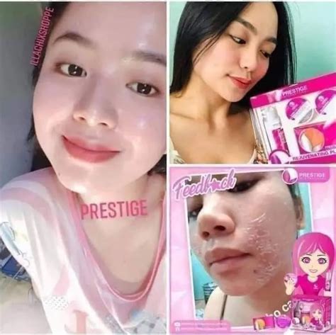 Prestige RejuvenatiNg set | Lazada PH