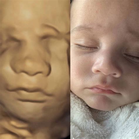 3D / 4D / 5D / 6D Ultrasound Scan Selangor, Puchong, Kuala Lumpur (KL ...