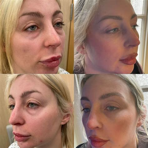 Rosealine Dawnxs: Her Before & After Results Are Truly Inspiring! Image 18