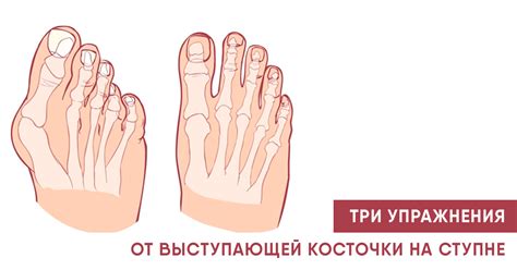 ORTIX / Ортопедические товары для здоровья - 347 Photos - Health/Beauty