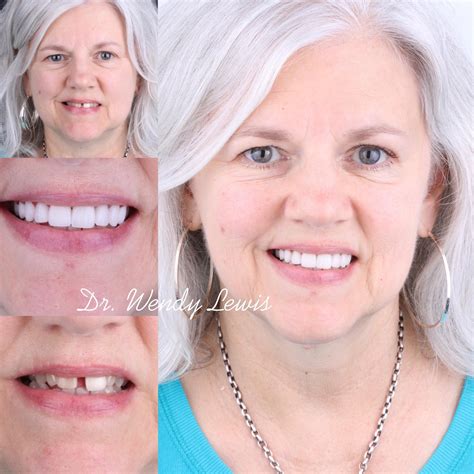 Gold Dust Dental Lab