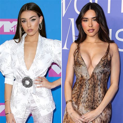 Madison Beer Plastic Surgery: Quotes, Before, After Photos | Life & Style