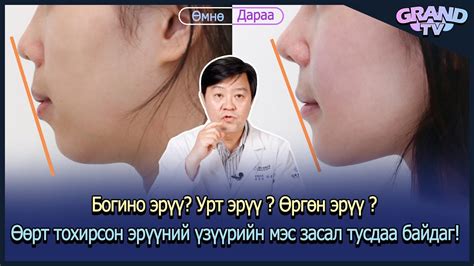 ГРАНД ГОО САЙХНЫ ЭМНЭЛЭГ - Эрүүний үзүүрийн мэс засал - YouTube
