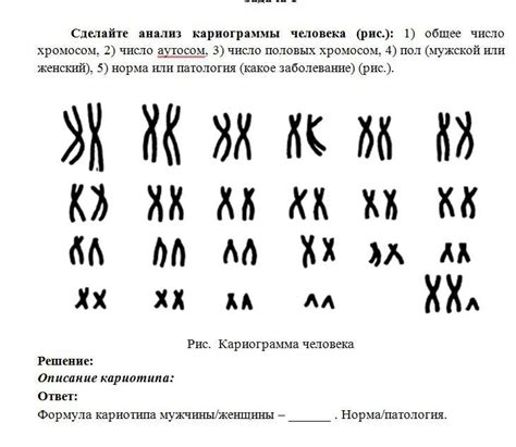 Сделайте анализ кариограммы человека (рис.): 1) общее число хромосом, 2 ...