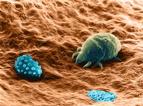 Broad Mite Larva and Egg, SEM - Stock Image - C028/3229 - Science Photo ...