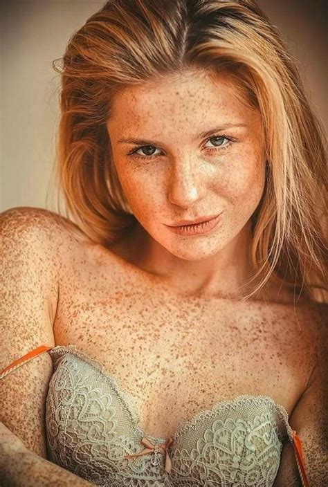 Pin by Martial Dufriche on Taches de rousseur in 2025 | Redheads, Red