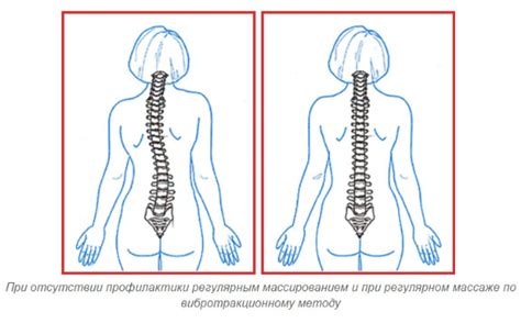 Аппарат для вытяжения и лечения грыжи позвоночника Ormed. «Ормед ...