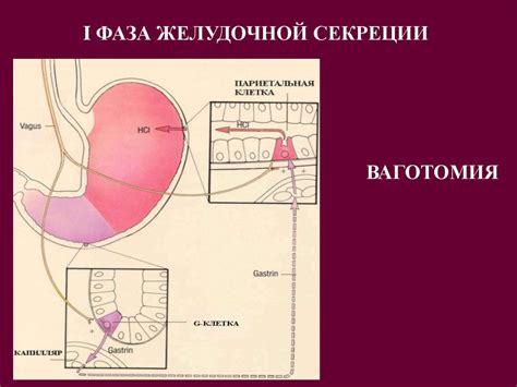Хирургическое лечение язвенной болезни желудка и двенадцатиперстной ...