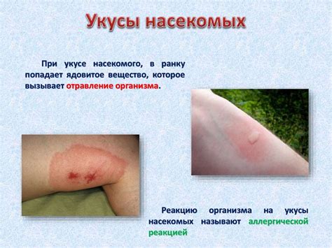 Оказание первой медицинской помощи при укусах змей и насекомых ...