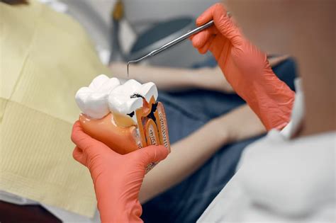 Нужно ли удалять зубы мудрости: мнение специалистов - Русская семерка