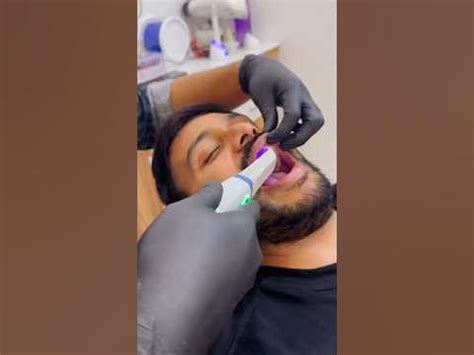A Good dental clinic in kochi | contact 9744020555 - YouTube