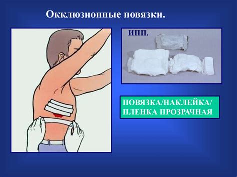 Травматический пневмоторакс - online presentation
