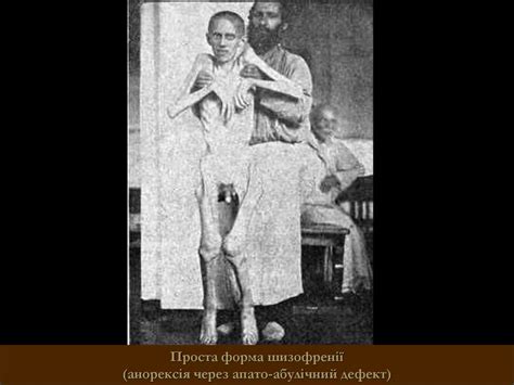 Шизофренія. Маячні розлади. Пізні парафренії. Шизотиповий розлад ...