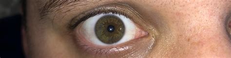 Hazel or central heterochromia? : r/eyes