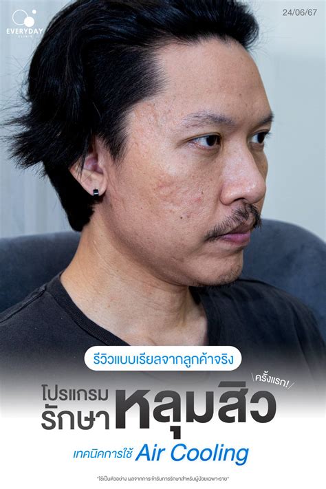 Everyday clinic - รีวิวแบบเรียลจากลูกค้าจริง 🥳... | Facebook