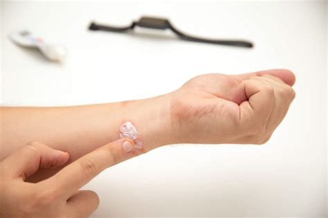 What Is Salve? Definition & Meaning