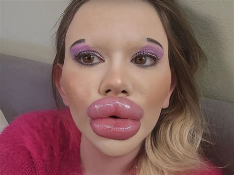 This girl really does have the biggest lips, but she wanted to change