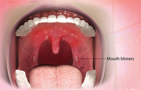 Health Condition : Symptoms, Causes, Treatment and More