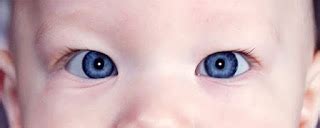 Pseudostrabismus Pictures, Test, Symptoms, Causes, Treatment - Health ...