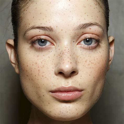 how to get rid of brown spots on face 7