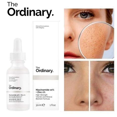The Ordinary Niacinamide 10% + Zinc 1% 30ml [Original] - eshop.lk
