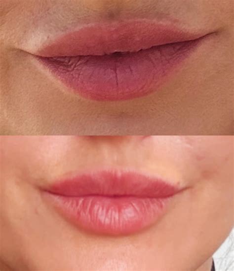 Skin Tech Clinic | York