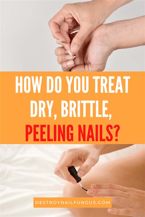 how to fix peeling fingernails