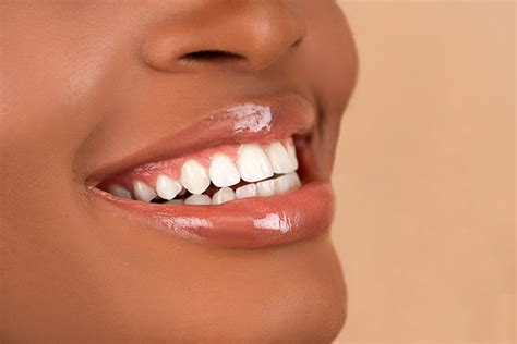 Risk Factors for Bleeding Gums and Gum Disease
