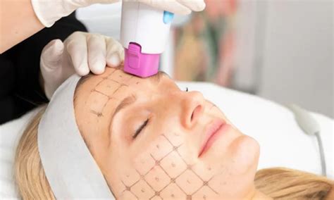 8 Aesthetic Clinics in Arizona Serving Thermage Skin Tightening