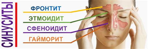 Синуситы лечение - Клиника Сити Мед Оренбург