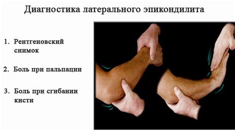 Эпикондилит локтевого сустава: симптомы и лечение, причины, виды патологии