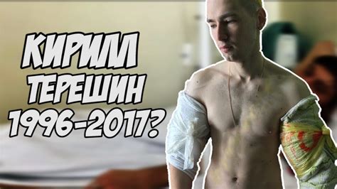 КИРИЛЛ ТЕРЕШИН И АМПУТАЦИЯ| РУКИ БАЗУКИ ИЛИ ТЯПКИ ЛАПКИ|Реакция ...