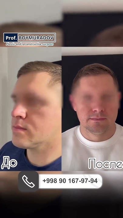 Прогения - YouTube