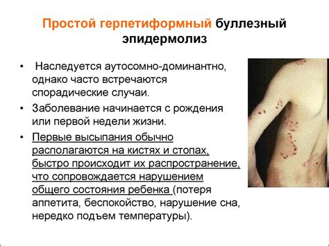 Случай из практики. Эпидермолиз буллёзный врожденный - презентация онлайн