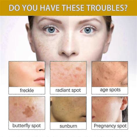 remove aging spots from face 1