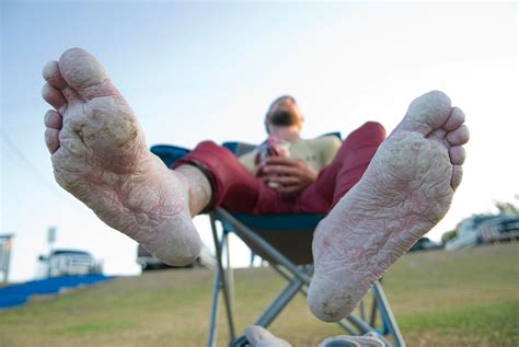 How to Care for Your Feet While Walking, Camping, and Hiking | National