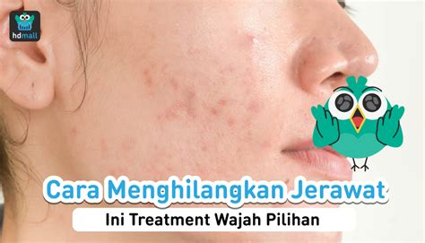 menghilangkan jerawat  bekasnya  treatment wajah hdmall