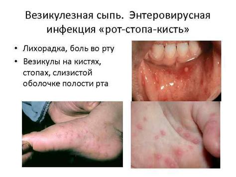 Дифференциальная диагностика сыпи в практике педиатра Сообщение подготовила