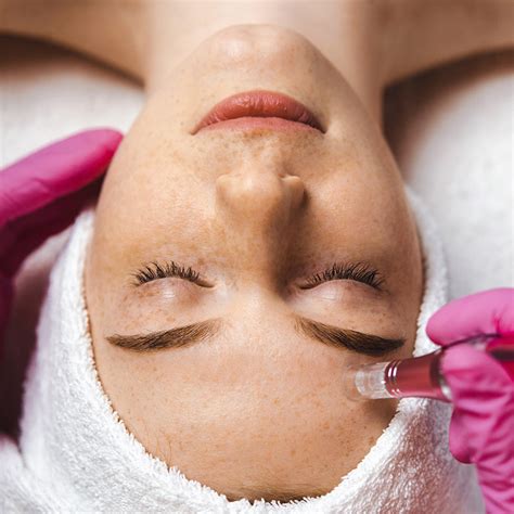 Schöne Haut durch Microdermabrasion