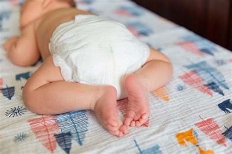 Опрелости у новорожденных детей: чем лечить, фото, симптомы