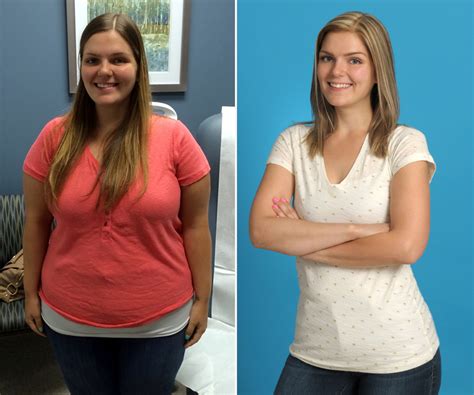 Weight Loss Images Before And After Download at Lon Taylor blog
