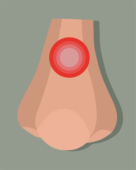 vector isolated illustration  sinusitis runny nose nasal congestion