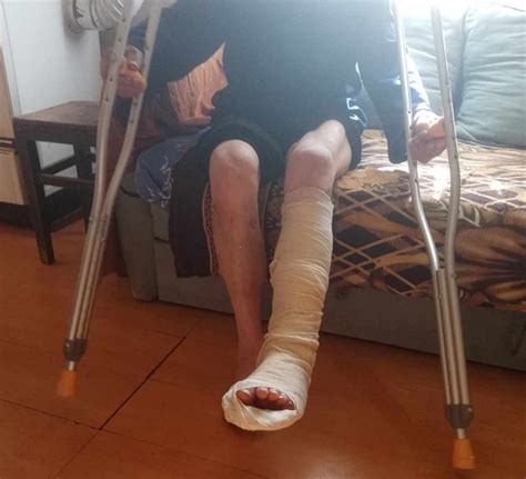 (ФОТО) Мечка нападнала 61-годишен сточар, му ги повредила нозете, грбот ...