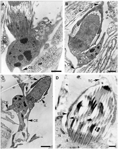 Transmission electron microscopy of flame cells. The complete ...