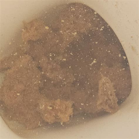 Phagocytizes Small Particles First Responders At Infection Site 1