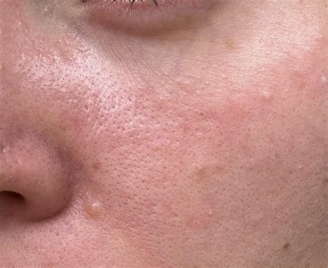orange skin  face