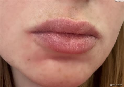 Бальзам для губ Golden Rose Glow kiss - «GOLDEN ROSE glow kiss 03» | отзывы